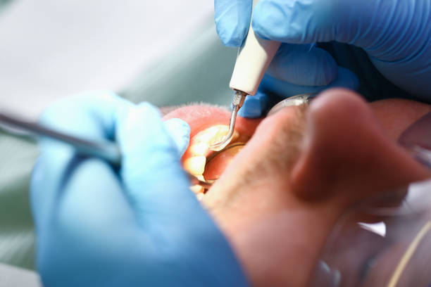 Best Emergency Dental Care for Broken or Chipped Teeth in Laingsburg, MI