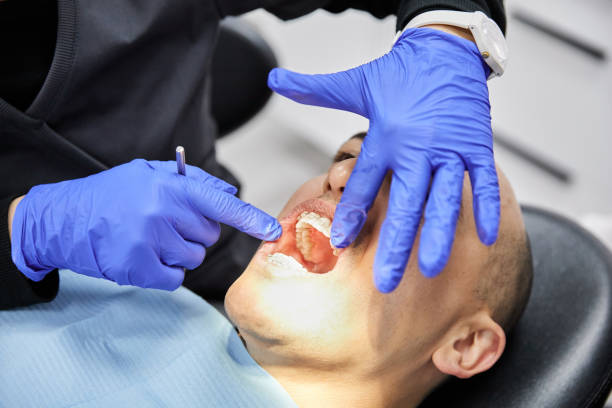 Best Emergency Tooth Extraction in Laingsburg, MI